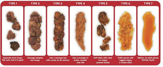 Làm gì khi trẻ bị táo bón